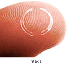 Corneal intacs on a finger.