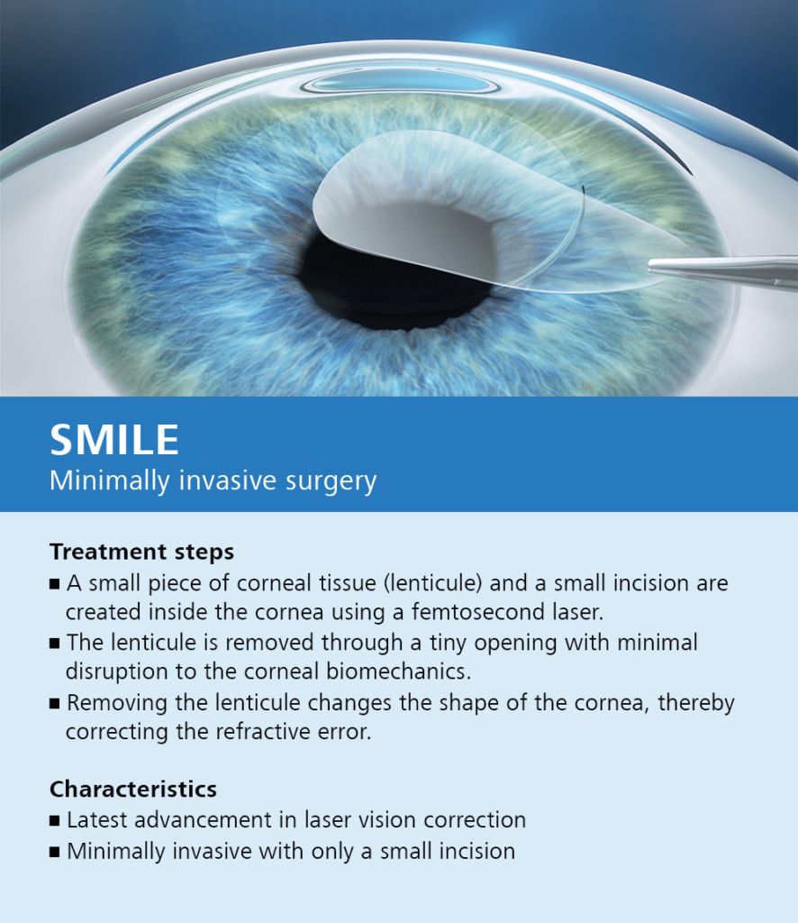 Caplan Eye Clinic – Custom LASIK – Laser Eye Surgery and Vision Correction  serving Greater New Orleans and the Northshore