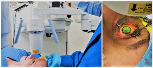 2 photos of crosslinking procedure